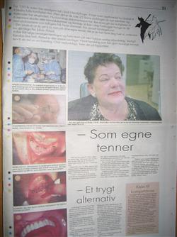 Avisartikkel fra Trønderavisa mars 1997, om hvordan tannimplantater føles som egne tenner.